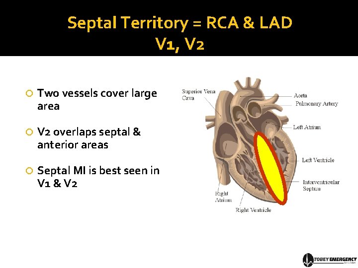 Septal Territory = RCA & LAD V 1, V 2 Two vessels cover large