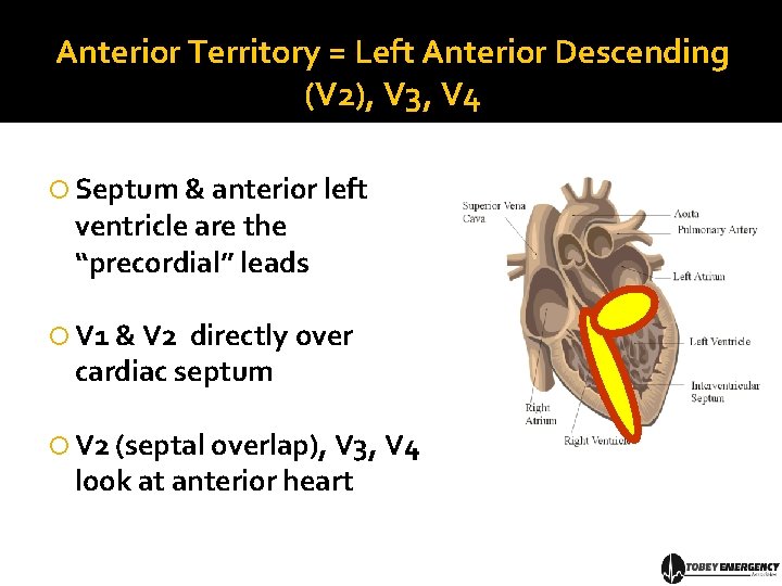 Anterior Territory = Left Anterior Descending (V 2), V 3, V 4 Septum &