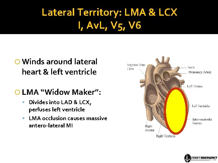 Lateral Territory: LMA & LCX I, Av. L, V 5, V 6 Winds around