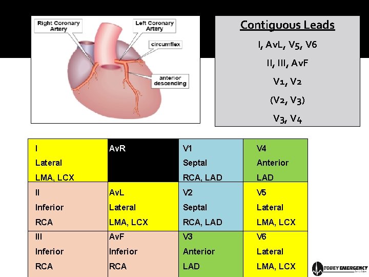 Contiguous Leads I, Av. L, V 5, V 6 II, III, Av. F V