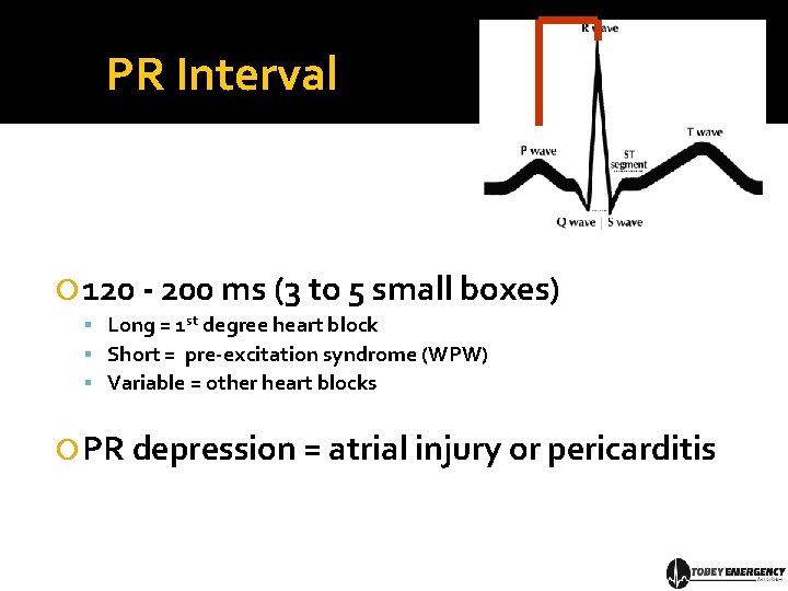 PR Interval 120 - 200 ms (3 to 5 small boxes) Long = 1