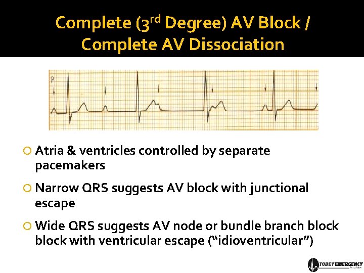 Complete (3 rd Degree) AV Block / Complete AV Dissociation Atria & ventricles controlled