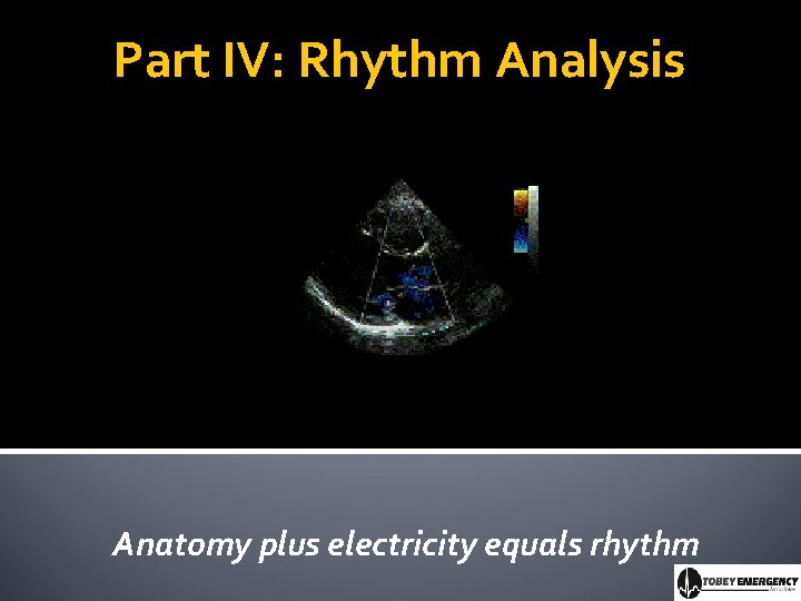 Part IV: Rhythm Analysis Anatomy plus electricity equals rhythm 