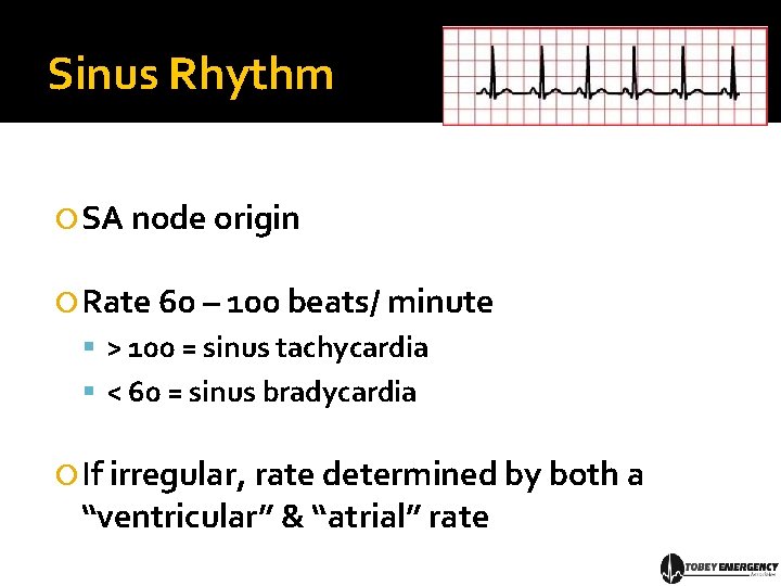 Sinus Rhythm SA node origin Rate 60 – 100 beats/ minute > 100 =