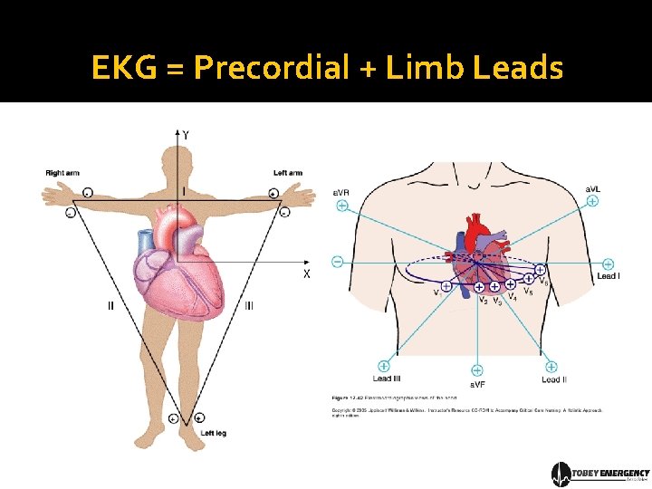 EKG = Precordial + Limb Leads 