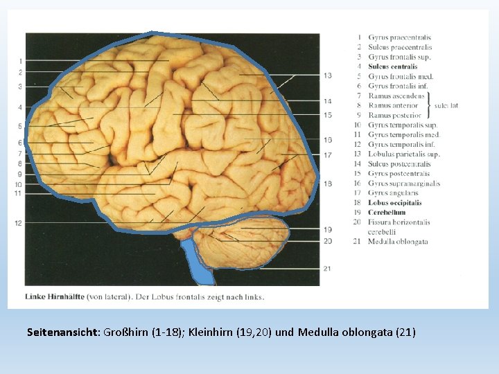 Seitenansicht: Großhirn (1 -18); Kleinhirn (19, 20) und Medulla oblongata (21) 