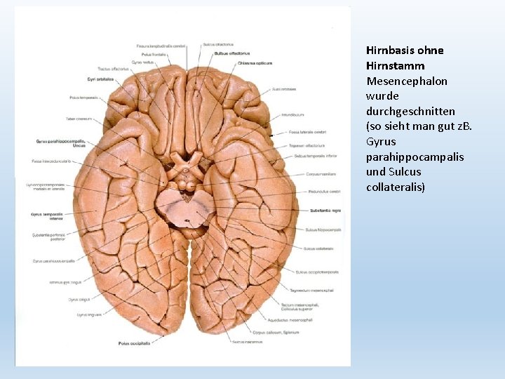 Hirnbasis ohne Hirnstamm Mesencephalon wurde durchgeschnitten (so sieht man gut z. B. Gyrus parahippocampalis