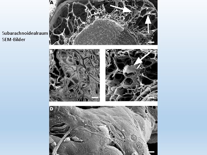 Subarachnoidealraum in SEM-Bilder 