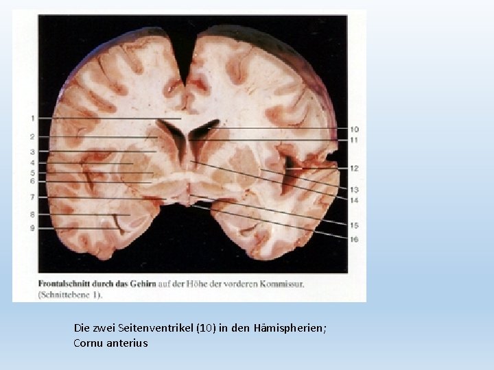 Die zwei Seitenventrikel (10) in den Hämispherien; Cornu anterius 