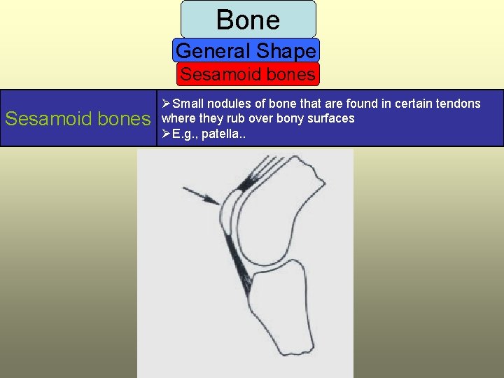 Bone General Shape Sesamoid bones ØSmall nodules of bone that are found in certain