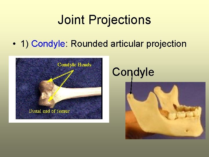 Joint Projections • 1) Condyle: Rounded articular projection Condyle 