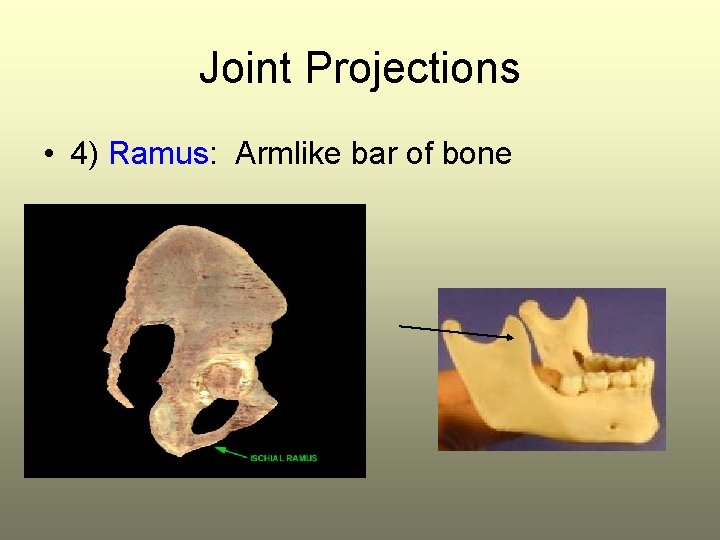 Joint Projections • 4) Ramus: Armlike bar of bone 