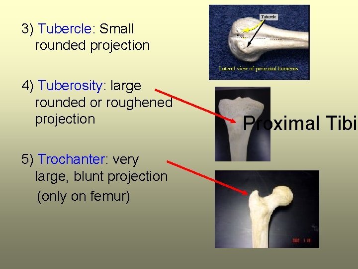 3) Tubercle: Small rounded projection 4) Tuberosity: large rounded or roughened projection 5) Trochanter: