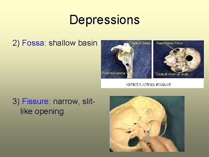 Depressions 2) Fossa: shallow basin 3) Fissure: narrow, slitlike opening 