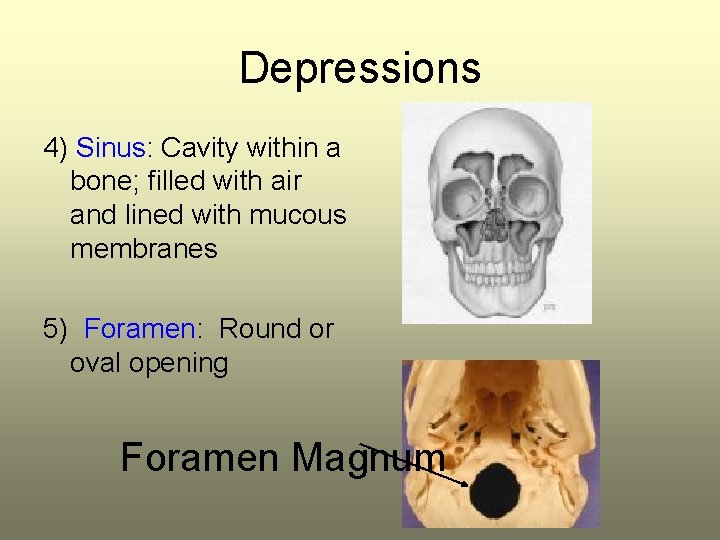 Depressions 4) Sinus: Cavity within a bone; filled with air and lined with mucous