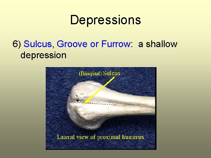 Depressions 6) Sulcus, Groove or Furrow: a shallow depression 