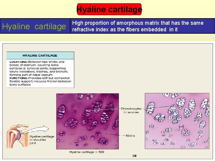 Hyaline cartilage High proportion of amorphous matrix that has the same refractive index as