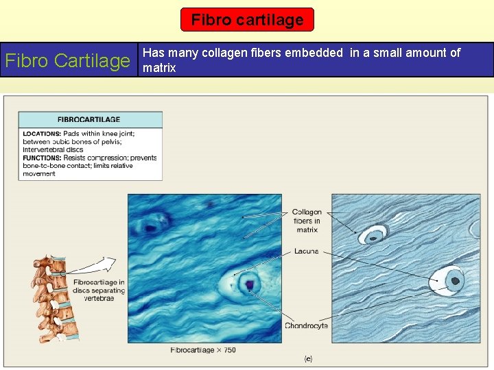 Fibro cartilage Fibro Cartilage Has many collagen fibers embedded in a small amount of