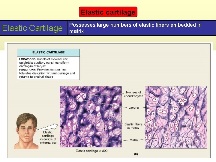 Elastic cartilage Elastic Cartilage Possesses large numbers of elastic fibers embedded in matrix 