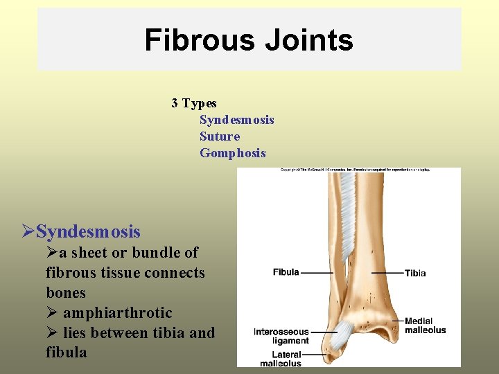 Fibrous Joints 3 Types Syndesmosis Suture Gomphosis ØSyndesmosis Øa sheet or bundle of fibrous