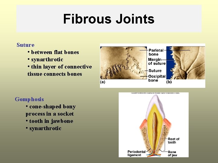 Fibrous Joints Suture • between flat bones • synarthrotic • thin layer of connective