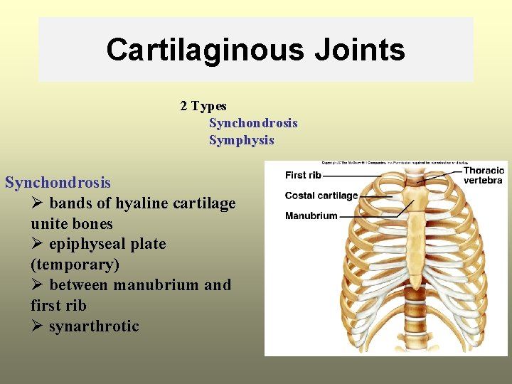 Cartilaginous Joints 2 Types Synchondrosis Symphysis Synchondrosis Ø bands of hyaline cartilage unite bones