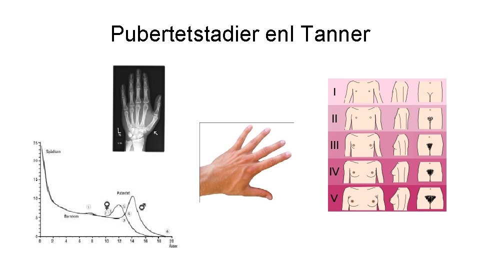 Pubertetstadier enl Tanner 