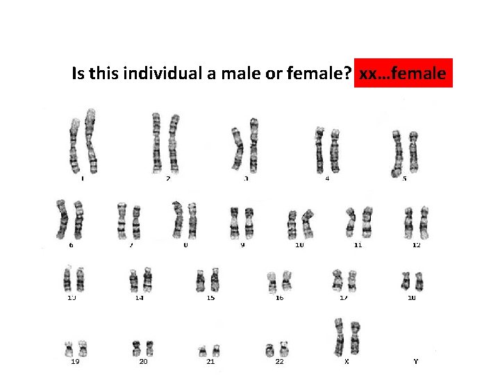 Is this individual a male or female? xx…female 