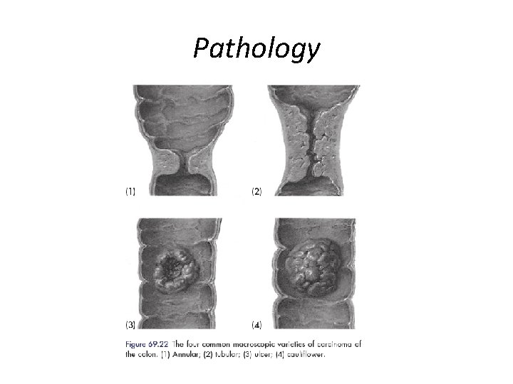 Pathology 