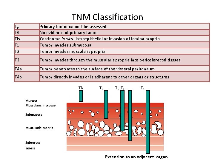 TNM Classification TX T 0 Tis T 1 T 2 Primary tumor cannot be