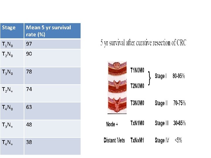 Stage Mean 5 yr survival rate (%) T 1 N 0 97 T 2