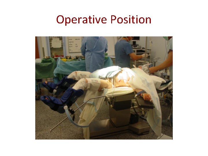 Operative Position 