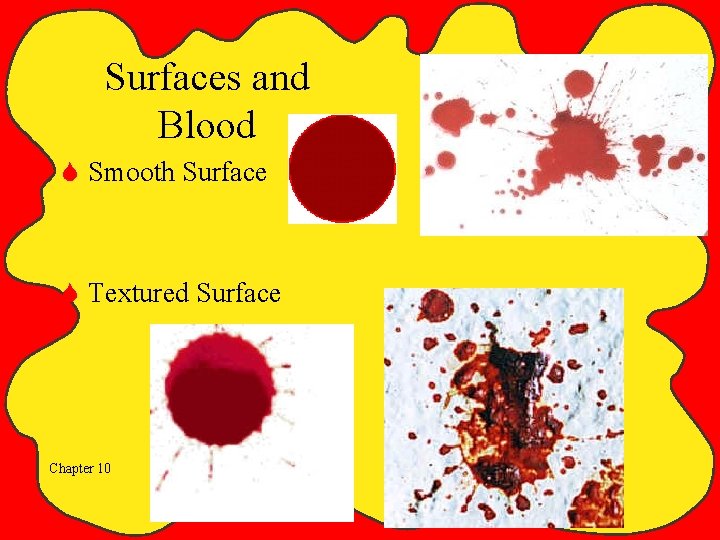 Surfaces and Blood S Smooth Surface S Textured Surface Chapter 10 