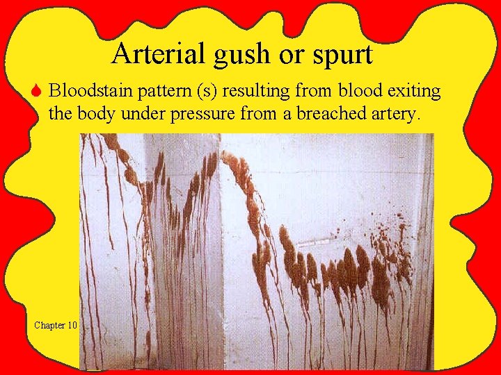 Arterial gush or spurt S Bloodstain pattern (s) resulting from blood exiting the body