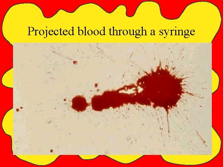 Projected blood through a syringe Chapter 10 
