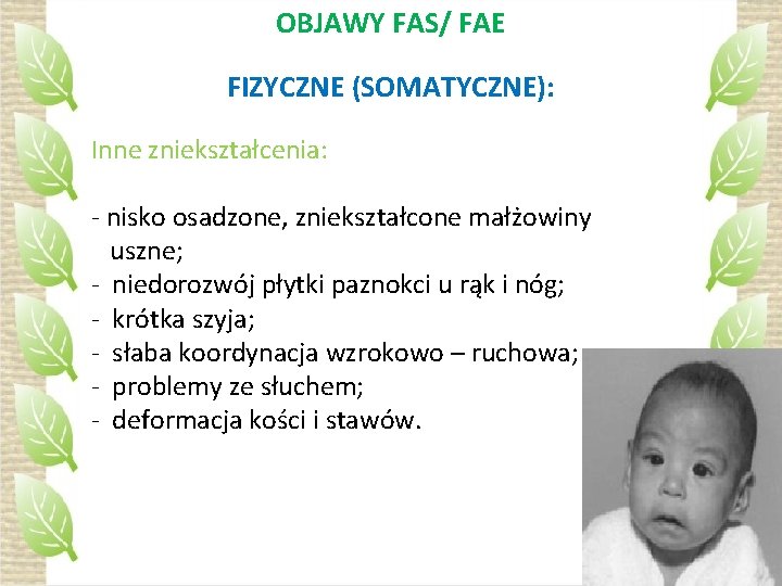 OBJAWY FAS/ FAE FIZYCZNE (SOMATYCZNE): Inne zniekształcenia: - nisko osadzone, zniekształcone małżowiny uszne; -