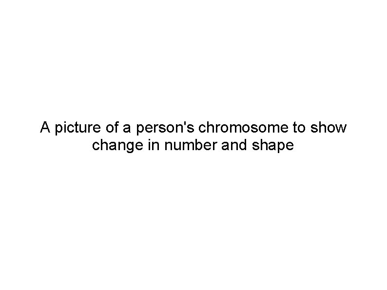 A picture of a person's chromosome to show change in number and shape 