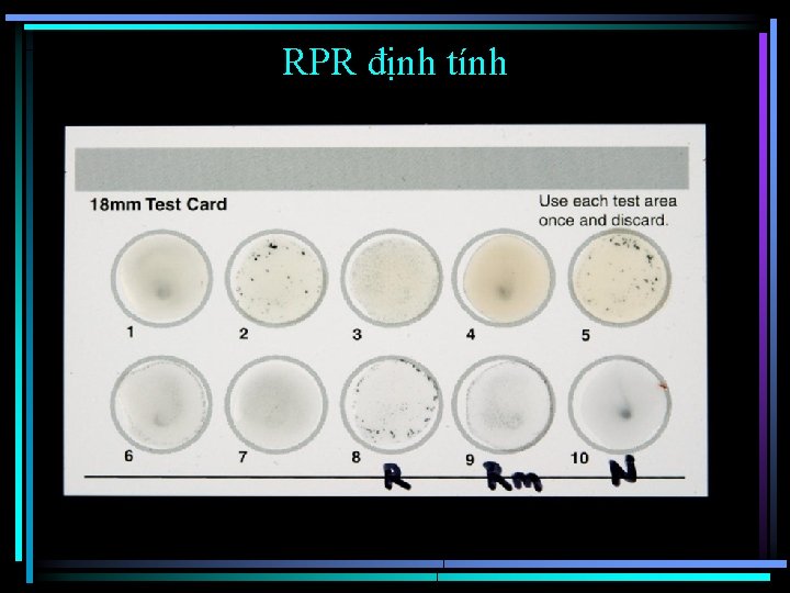 RPR định tính 