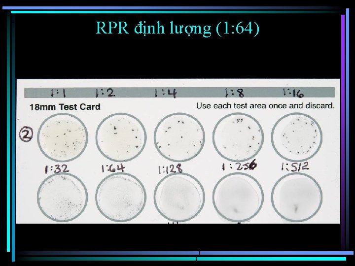 RPR định lượng (1: 64) 