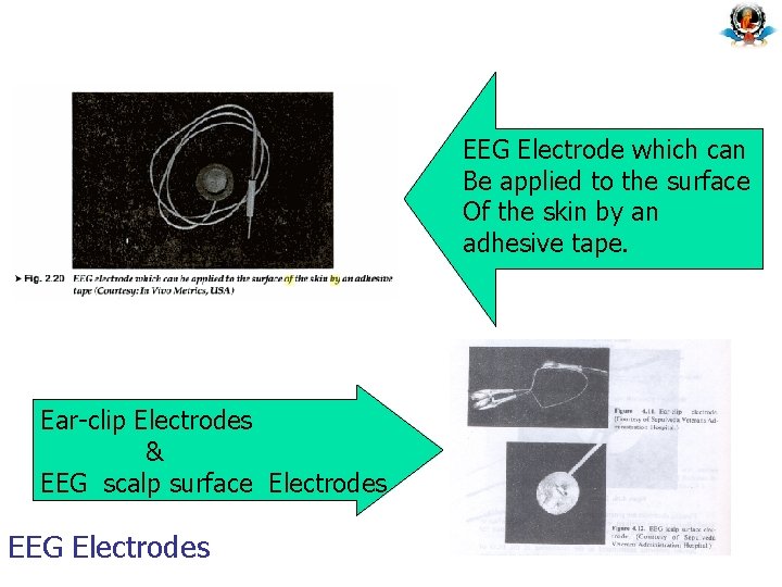 EEG Electrode which can Be applied to the surface Of the skin by an