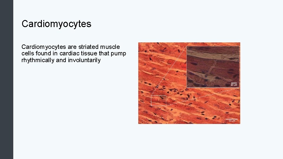 Cardiomyocytes are striated muscle cells found in cardiac tissue that pump rhythmically and involuntarily