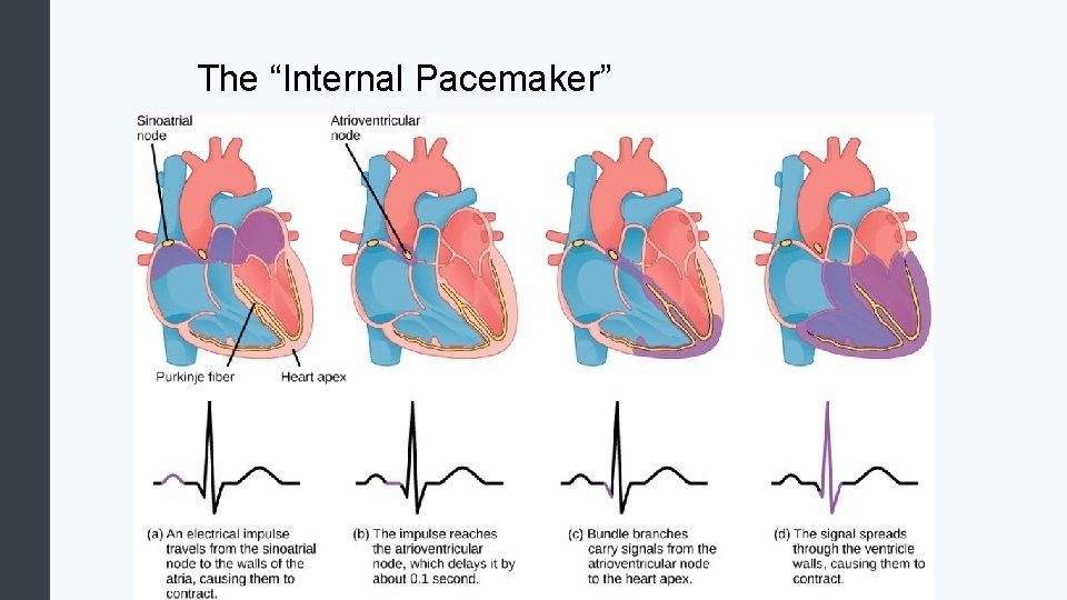 The “Internal Pacemaker” 