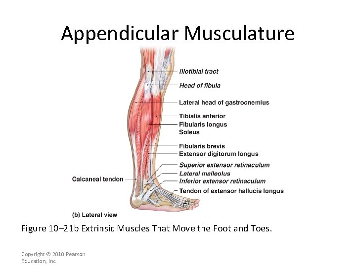 Appendicular Musculature [INSERT FIG. 11. 22 b] Figure 10– 21 b Extrinsic Muscles That