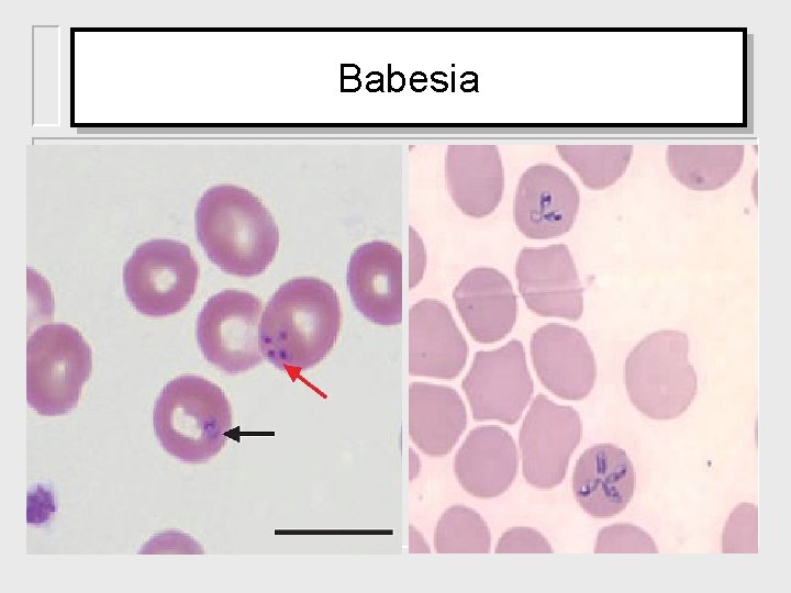 Babesia 