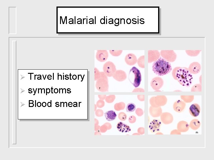 Malarial diagnosis Travel history Ø symptoms Ø Blood smear Ø f o v m
