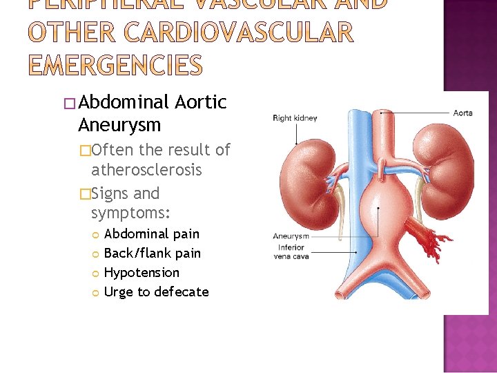 �Abdominal Aortic Aneurysm �Often the result of atherosclerosis �Signs and symptoms: Abdominal pain Back/flank