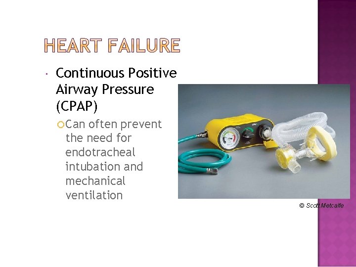  Continuous Positive Airway Pressure (CPAP) Can often prevent the need for endotracheal intubation