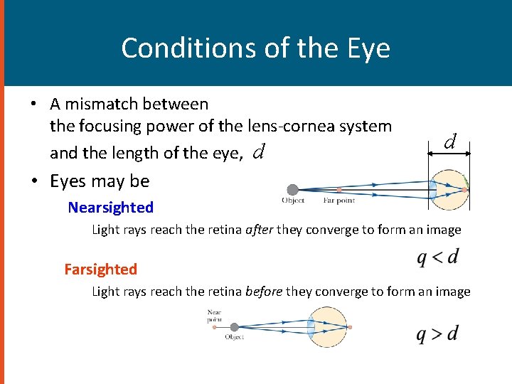 Conditions of the Eye • A mismatch between the focusing power of the lens-cornea