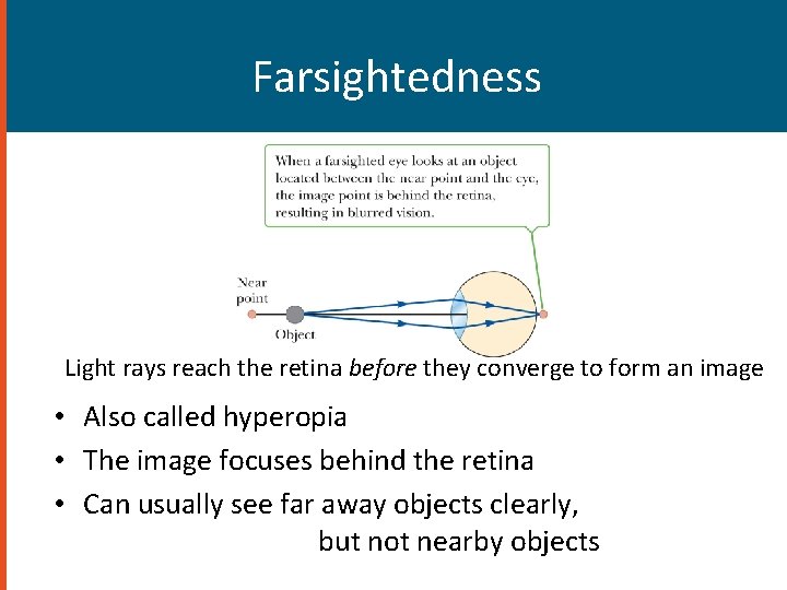 Farsightedness Light rays reach the retina before they converge to form an image •