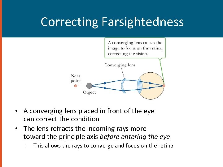 Correcting Farsightedness • A converging lens placed in front of the eye can correct